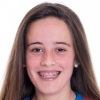 Alba Álvarez